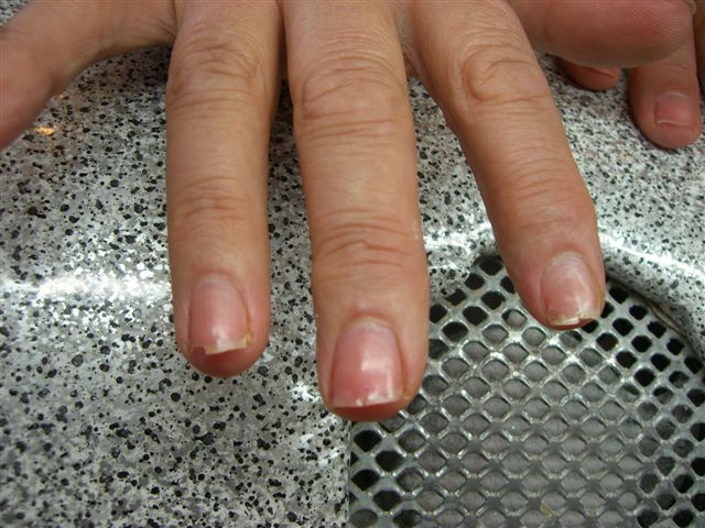 Faq Haufig Gestellte Fragen Bei Nagelproblemen Nageldesign Nagelmodellage Nagelrekonstruktion Nagelstudio Bremen Conny Co Fachinstitut Fur Handpflege Nagelpflege